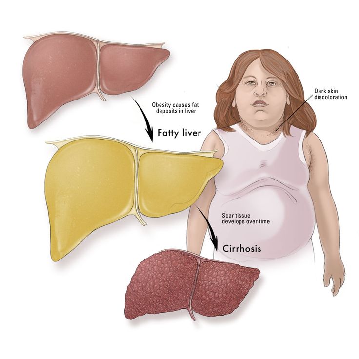 The Use of Cialis in Hepatic Impairment Patients